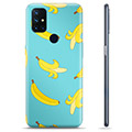 OnePlus Nord N10 5G TPU Suojakuori - Banaanit